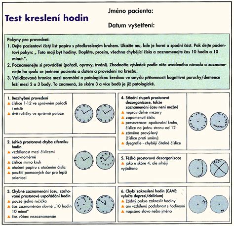 Instructional webinar on the administration and scoring of the montreal cognitive assessment (moca). Clock Drawing Test Results / Clock Drawing Test Youtube ...