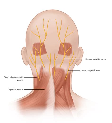Occipital Nerve Block Occipital Neuralgia Treatment Pain Spa