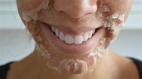 Diy Chemical Skinface Peeling Solution Deep Exfoliant Youtube