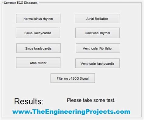 Ecg Simulation Using Matlab The Engineering Projects