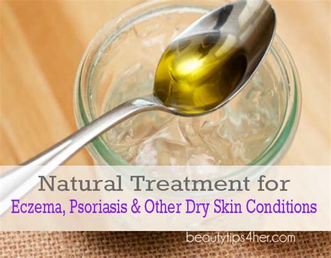 Natural Remedies For Psoriasis Eczema And Other Skin