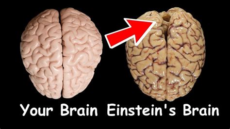 Your Brain Vs Einsteins Brain Youtube
