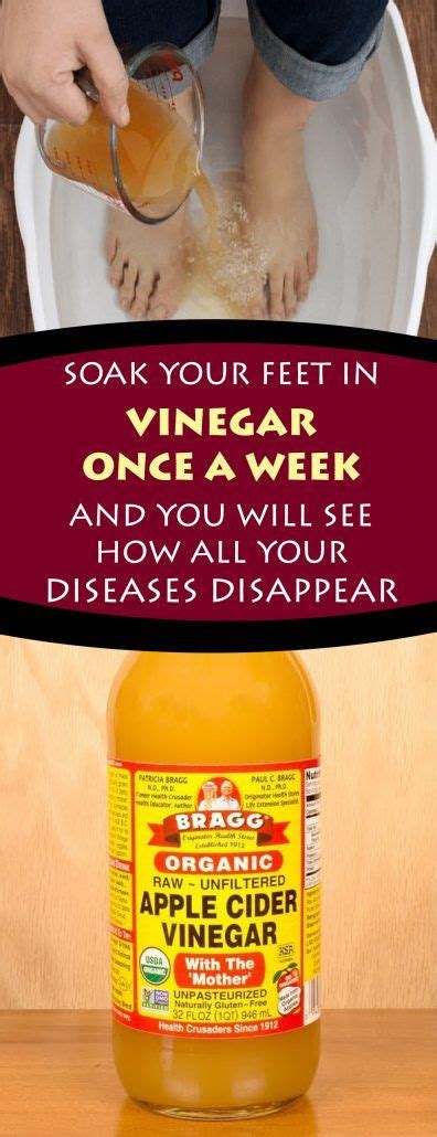 Soak Your Feet In Vinegar Health Remedies Natural Remedies Health
