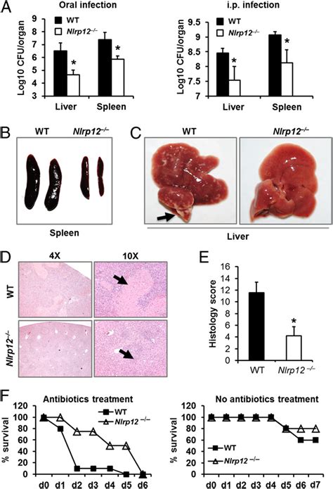 Read more about symptoms, diagnosis, treatment salmonella infection causes common gastroenteritis as well as typhoid fever, which is a serious. Absence of NLRP12 protects mice from exacerbated ...
