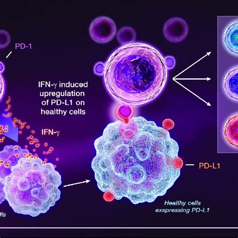 In The Setting Of Cancer PD L1 Is Upregulated On Tumor Cells In