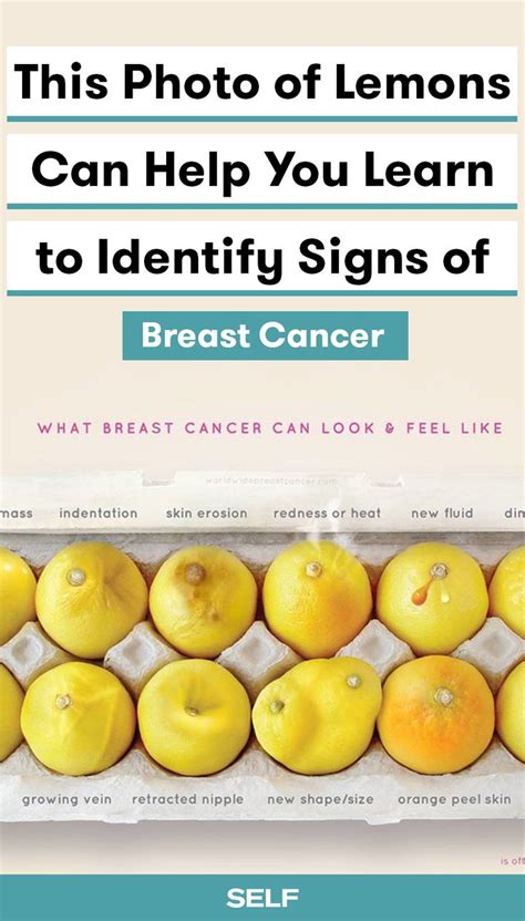 Dimpling of the breast tissue can be a sign of a serious form of cancer known as inflammatory breast cancer. 1080 best Health & Wellness images on Pinterest | Wellness ...