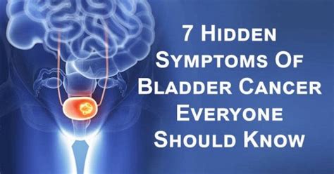 Early Detection Of Bladder Cancer Here Are 7 Symptoms Health Queen
