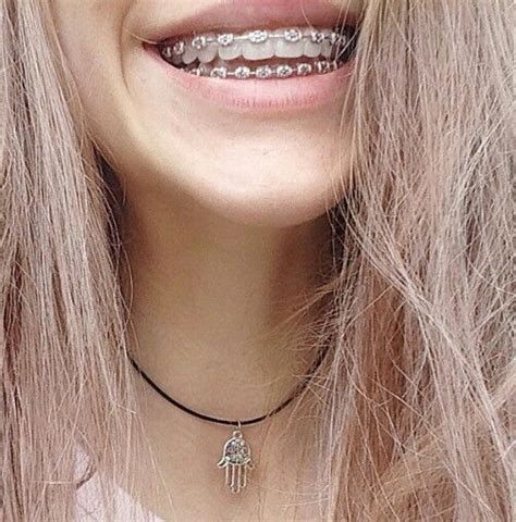 Braces Retainer Braces And Glasses Cute Braces Colors Braces Tips Getting Braces Brace Face