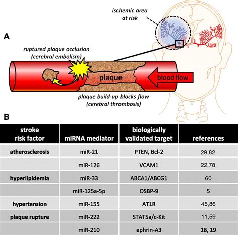 Microrna In Ischemic Stroke Etiology And Pathology Physiological Genomics