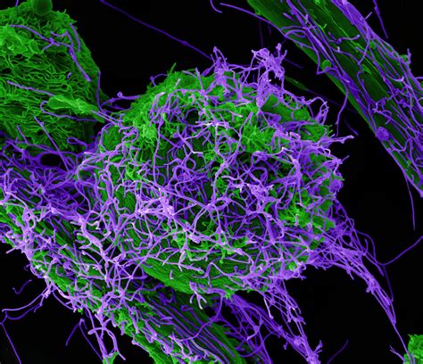 NIH awards $12 million for antiviral therapeutic development | National
