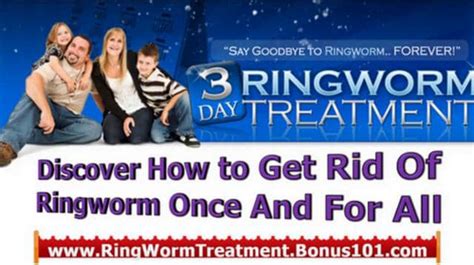 Treatment Of Ringworm Ringworm In Babies Ringworm Treatments On Vimeo