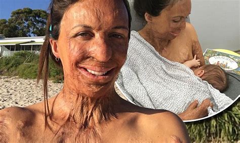 Turia Pitt Jokes Shes At Nudist Beach In Instagram Selfie Min Video Bpornvideos Com