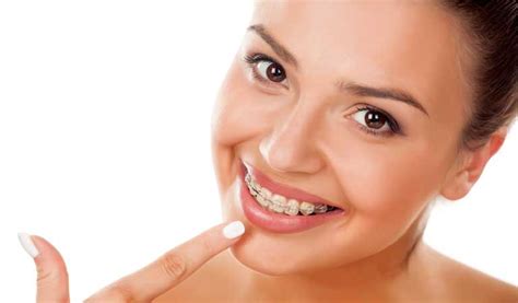 Oral Hygiene Tips For People With Braces Orthodontic Blog Orthodontic Specialists Of Lake