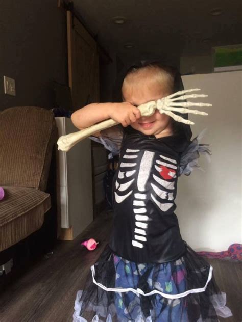 Girl 3 Shows Off Arm Amputation With These Badass Halloween Costumes