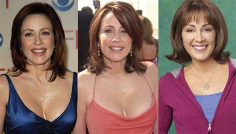 Patricia Heaton Plastic Surgery Before And After Pictures 2018