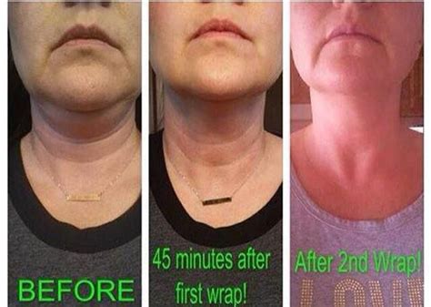 Before And After Get Rid Of The Turkey Neck And Wrinkles It Works