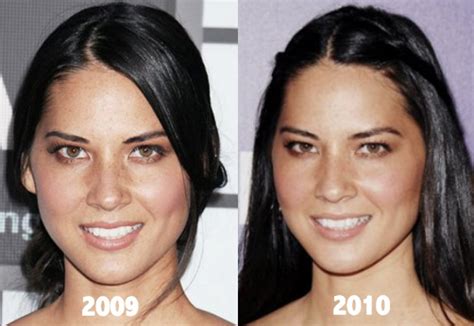 Olivia Munn Plastic Surgery Before And After Photos