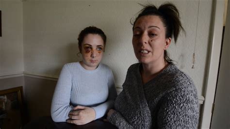 Mother’s Horror Over Attack On Daughter Brutally Beaten And Robbed In Street Youtube