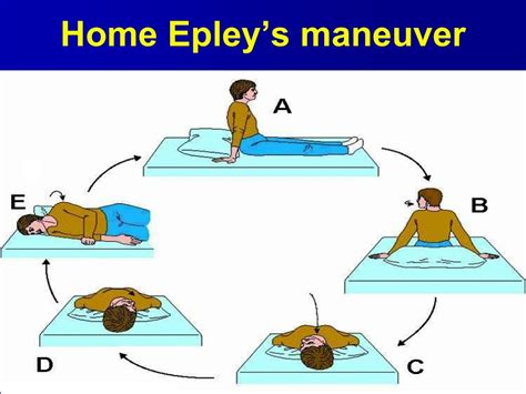 Eply Maneuver Epley Maneuver Using Telemed The Home Epley Maneuver