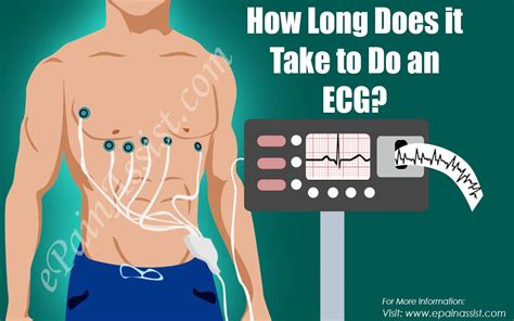 Tests at new york state health and hospital are still pcr (polymerase chain. How Long Does it Take to Do an ECG?