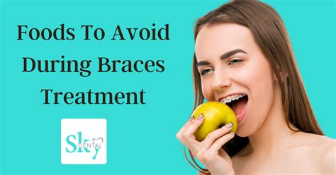 Food To Avoid During Braces Treatment Sky Dental Vijayawada