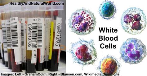 Elevated White Blood Cell Wbc Count Causes Treatments And More