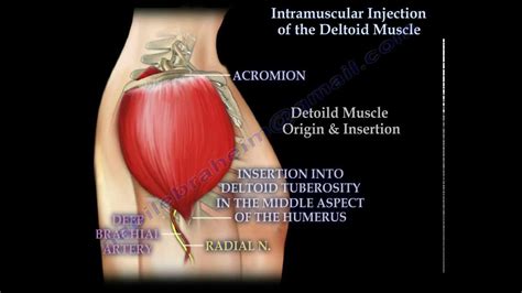 Intramuscular Injection Of The Deltoid Muscle Everything You Need To Know Dr Nabil Ebraheim