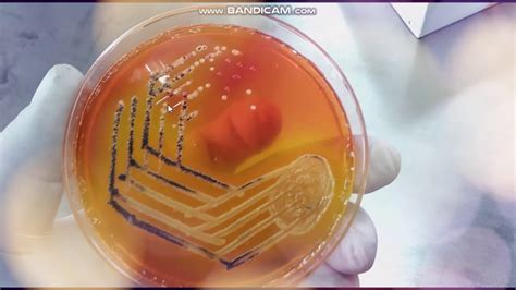 In vitro (canlı hücre dışında) yapılan standart mikrobiyolojik analizlerde salmonella ve shigella için selektif katı besiyeri olarak kullanılır. Xylose Lysine Deoxycholate agar | XLD | Selective medium ...