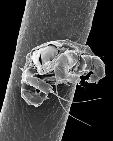 Mite On Human Hair Photograph By Dennis Kunkel Microscopyscience Photo