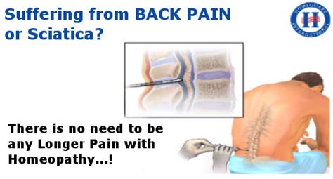 Sciatica Disease Can Be Cured Permanently At Homeocare International