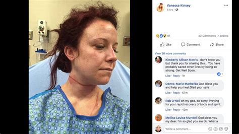 Woman Survives Assault On Colorado Trail Suspect Arrested Miami Herald