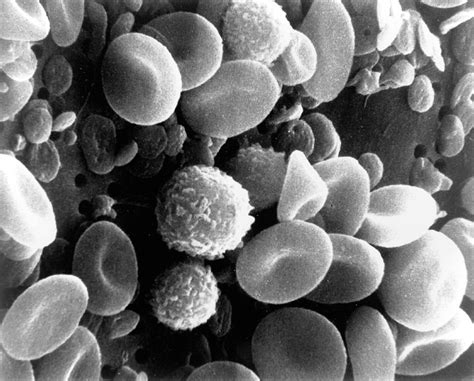 How Do White Blood Cells Actually Kill Cancer Cells Biosky