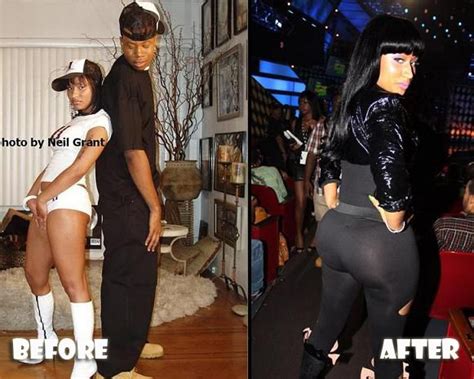 Nicki Minaj Before And After Butt Implants Butt Implants Before And After Pinterest Nicki