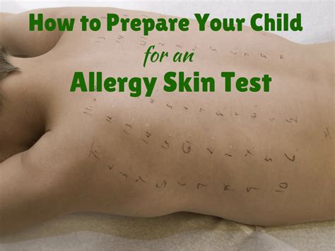 Your sensitivity, you should not test for food allergies on your own. How to Prepare Your Child for an Allergy Skin Test