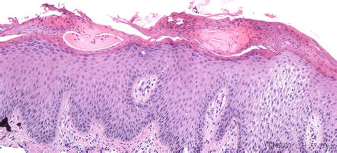 Figure 532 Derm In Review