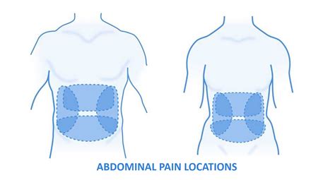 Abdominal Pain When To See A Gastroenterologist For Treatment