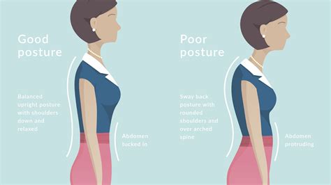 Good Posture Vs Bad Posture Mount Joy Rehab