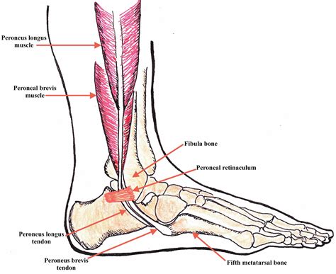 Peroneal Tendonitis Causes Symptoms Diagnosis Treatment Recovery The Best Porn Website