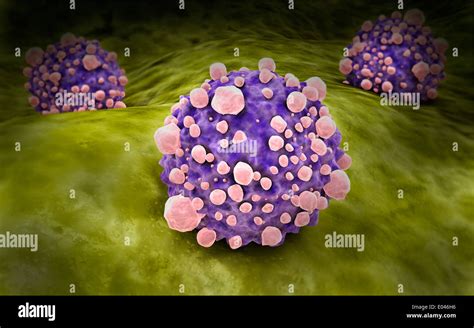 Microscipic View Of Pancreatic Cancer Cells Stock Photo Alamy