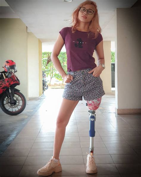Amputee Legs Stumps And Prostheses — A Photoset About Various Colored