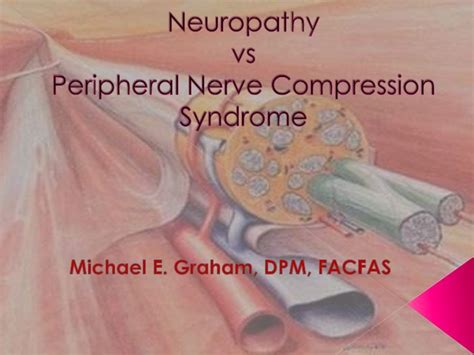 Peripheral Nerve Compression Syndrome