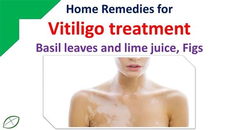 Best Natural Home Remedies For Vitiligo Treatmentbasil Leaves And Lime