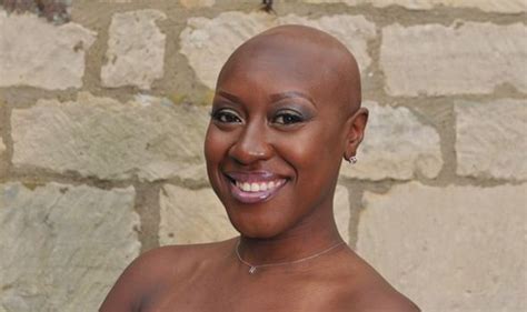 Bald Women Pose For Nude Charity Calendar For Alopecia Uk Health Life And Style Uk