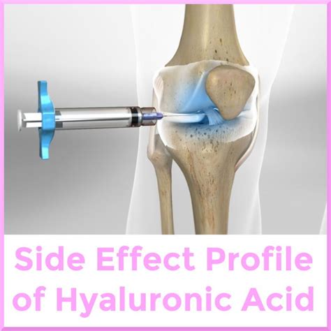 Side Effects Of Intra Articular Knee Hyaluronic Acid Injection Sports Medicine Review