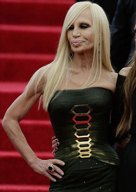 Donatella Versace Before After I Danni Della Chirurgia Estetica