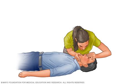 Cardiopulmonary Resuscitation Cpr First Aid Mayo Clinic