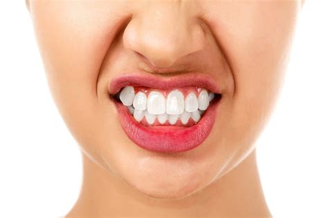How To Restore Your Smile After Being Worn Down By Bruxism Balsall