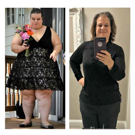 Maybe you would like to learn more about one of these? Kimberly celebrates 215-pound weight loss after gastric ...