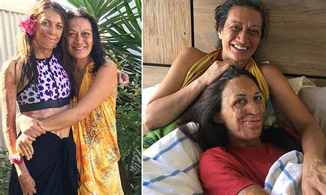 Turia Pitt Explains How Her Mum Taught Her Perseverance Daily Mail Femail Scoopnest
