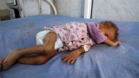 ‘a Hideous Milestone In The 21st Century Cholera Cases In Yemen Pass 1 Million Colorado